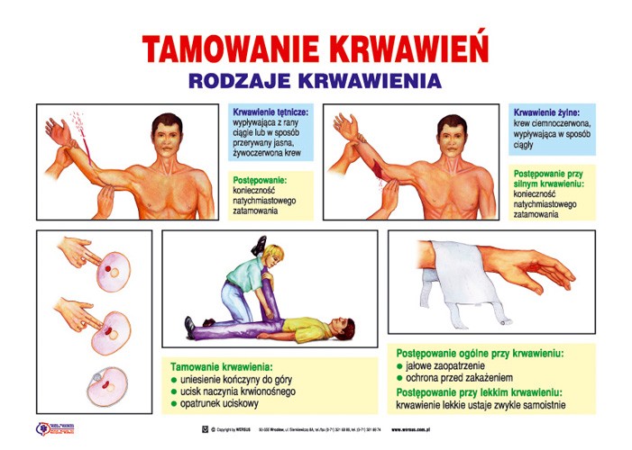 Tamowanie Krwawień I Krwotoków Edb Pierwsza pomoc 21 plansz - Pierwsza pomoc plansze - Szkoła Marzeń